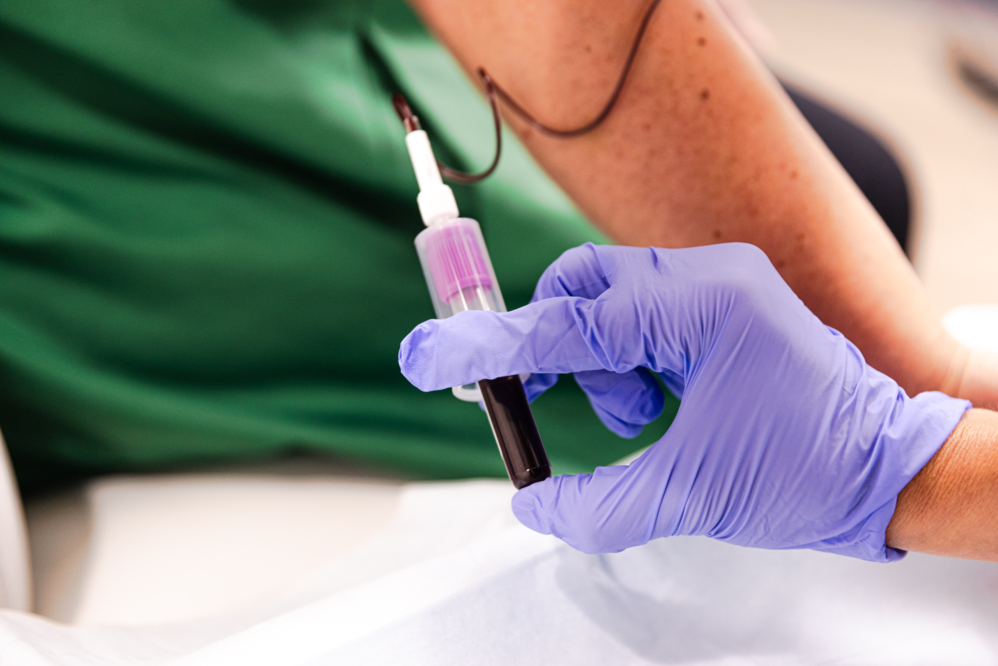 Close up of a gloved hand drawing blood from a patient's arm for Hormone Therapy Near Brookhaven.