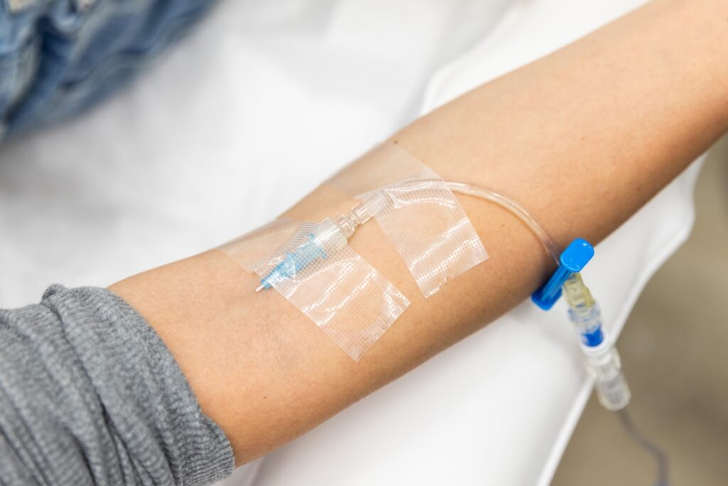 A patient received amino acid treatment in Sandy Springs via intravenous infusion.