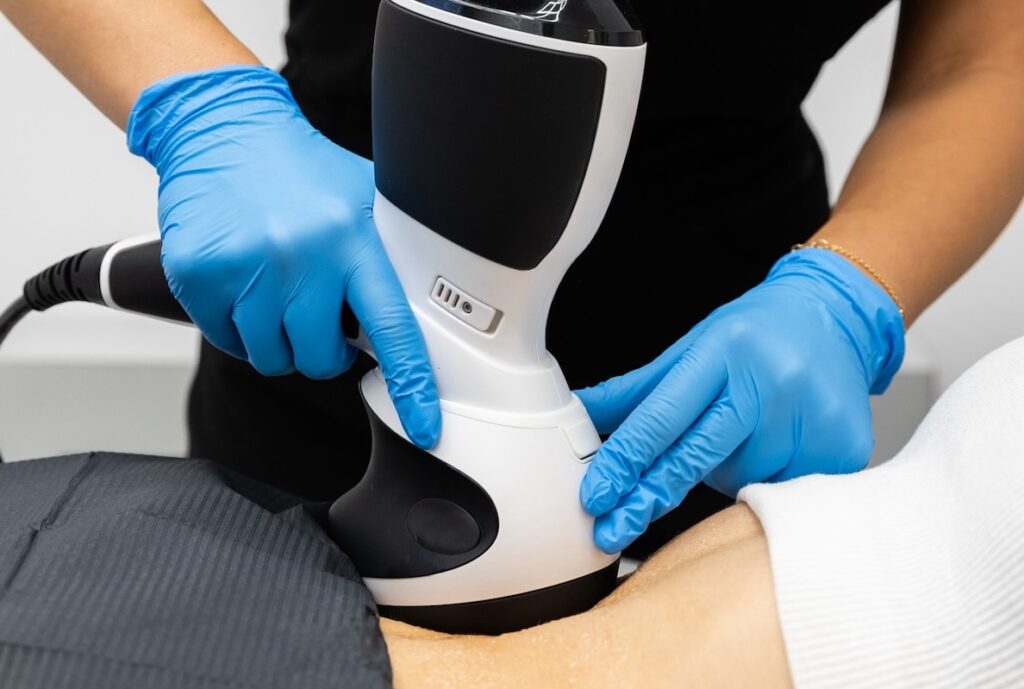 A team member at WellnestMD uses V-Form to provide cellulite treatment near Brookhaven on a patient's abdomen.