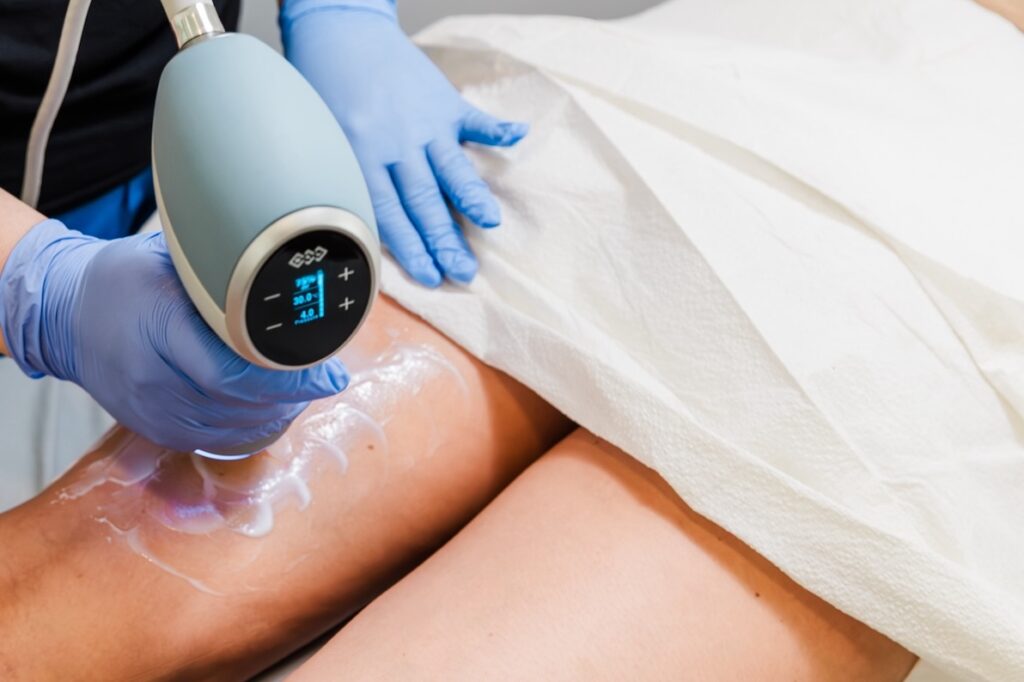 A provider uses Emtone on the back of a patient's thigh for cellulite treatment near Brookhaven.